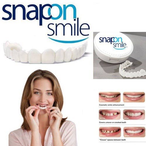 Snapon Smile Temporary Tooth Kit
